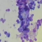 Malassezia fungus
